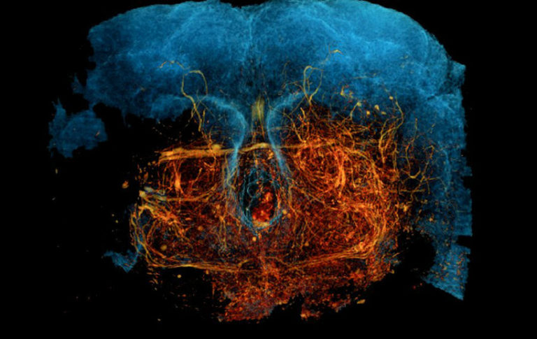 X-ray Microscopic Technique Can Image Individual Nerves